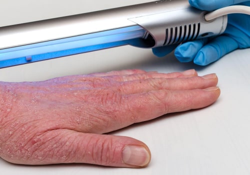 The Dangers of UV Light Exposure: Pros and Cons